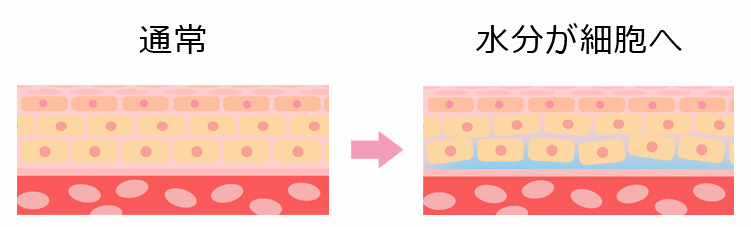 水分が血管から漏れ出るイメージ